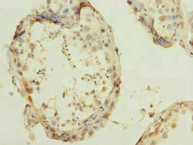 Immunohistochemistry (Formalin/PFA-fixed paraffin-embedded sections) - Anti-BOG antibody (AB235511), expandable thumbnail