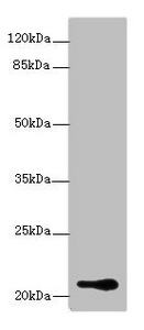 Western blot - Anti-BOG antibody (AB235511), expandable thumbnail
