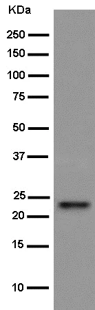 Western blot - Anti-Bok antibody [EPR15331] (AB186745)