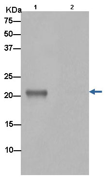 Immunoprecipitation - Anti-Bok antibody [EPR15331] - BSA and Azide free (AB232610)