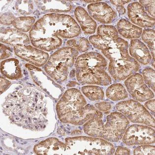 Immunohistochemistry (Formalin/PFA-fixed paraffin-embedded sections) - Anti-BOLA3 antibody (AB185339)