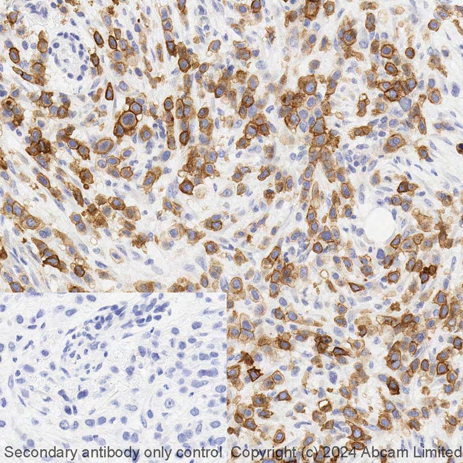 Immunohistochemistry (Formalin/PFA-fixed paraffin-embedded sections) - BOND Rx - Anti-B7H4 antibody [EPR20236] (AB321955), expandable thumbnail