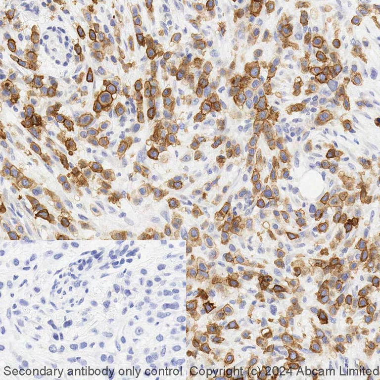 Immunohistochemistry (Formalin/PFA-fixed paraffin-embedded sections) - BOND RX - Anti-B7H4 antibody [EPR20236] (AB321955)