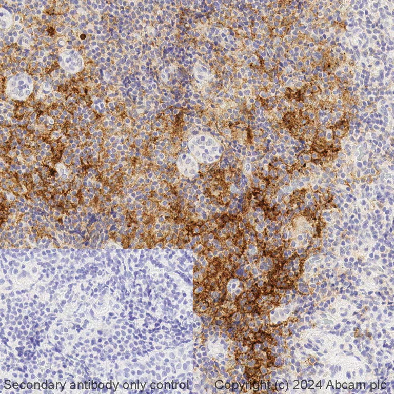 Immunohistochemistry (Formalin/PFA-fixed paraffin-embedded sections) - BOND RX - Anti-CCR6 antibody [EPR22259] (AB325197)