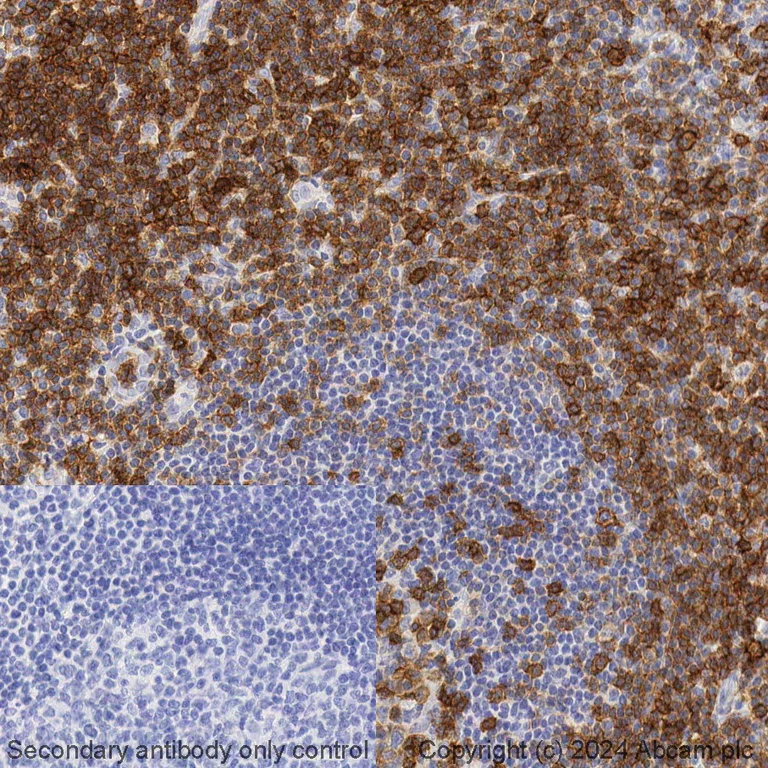 Immunohistochemistry (Formalin/PFA-fixed paraffin-embedded sections) - BOND RX - Anti-CD27 antibody [EPR8569] (AB325199)