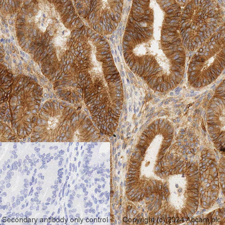 Immunohistochemistry (Formalin/PFA-fixed paraffin-embedded sections) - BOND RX - Anti-CD276 antibody [EPR27429-173] (AB325200)