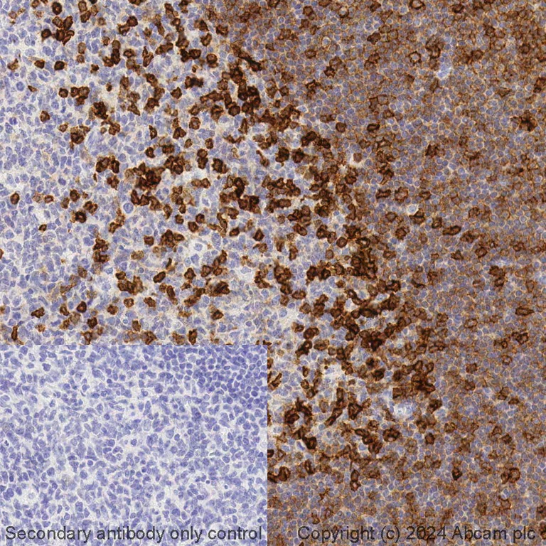 Immunohistochemistry (Formalin/PFA-fixed paraffin-embedded sections) - BOND RX - Anti-CD69 antibody [EPR21814] (AB325202)