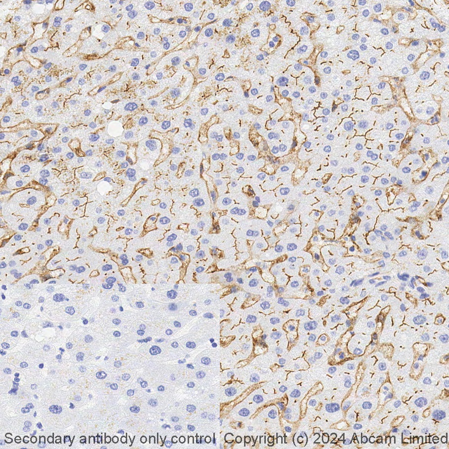 Immunohistochemistry (Formalin/PFA-fixed paraffin-embedded sections) - BOND Rx - Anti-CD73 antibody [EPR6114] (AB321953), expandable thumbnail
