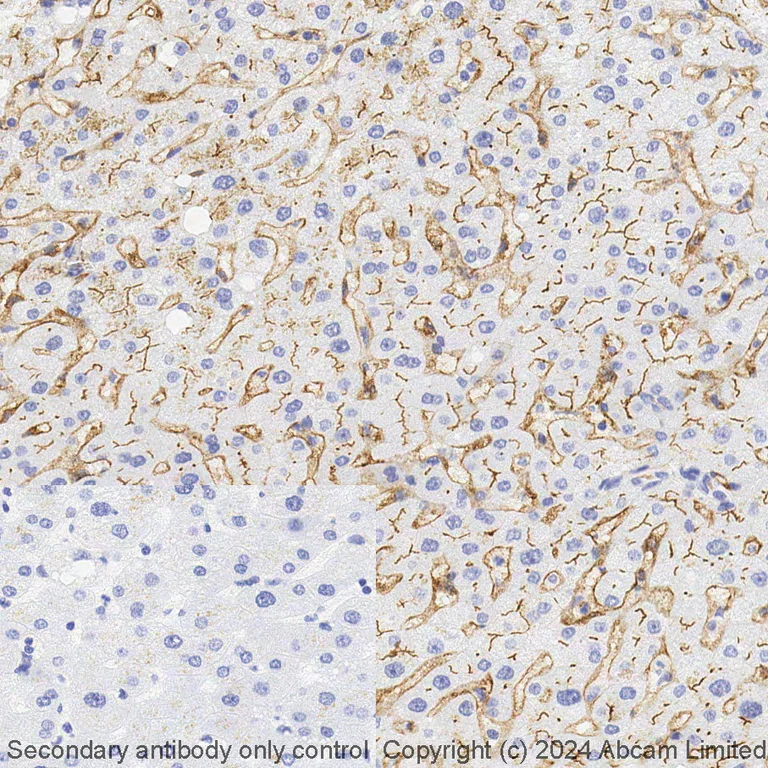 Immunohistochemistry (Formalin/PFA-fixed paraffin-embedded sections) - BOND RX - Anti-CD73 antibody [EPR6114] (AB321953)
