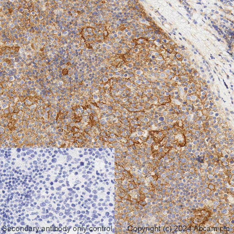 Immunohistochemistry (Formalin/PFA-fixed paraffin-embedded sections) - BOND RX - Anti-CD81 antibody [EPR21916] (AB325203)
