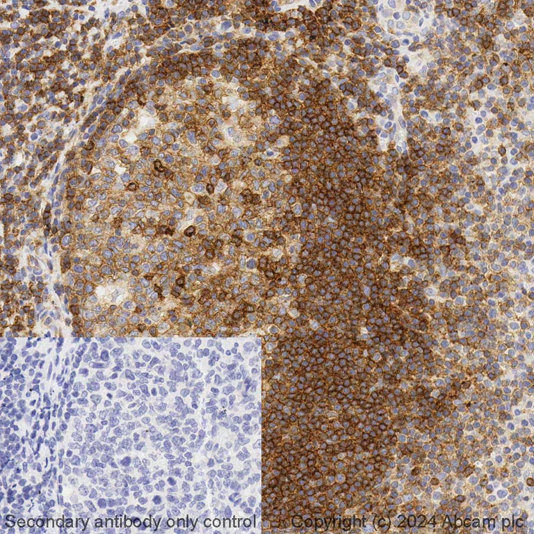 Immunohistochemistry (Formalin/PFA-fixed paraffin-embedded sections) - BOND RX - Anti-CXCR5 antibody [EPR23463-30] (AB325204)