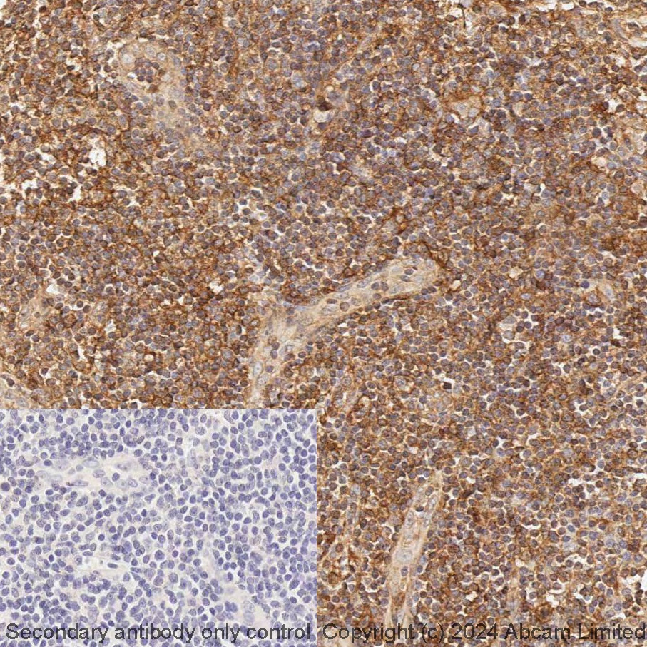 Immunohistochemistry (Formalin/PFA-fixed paraffin-embedded sections) - BOND Rx - Anti-HLA A antibody [EP1395Y] (AB321950), expandable thumbnail