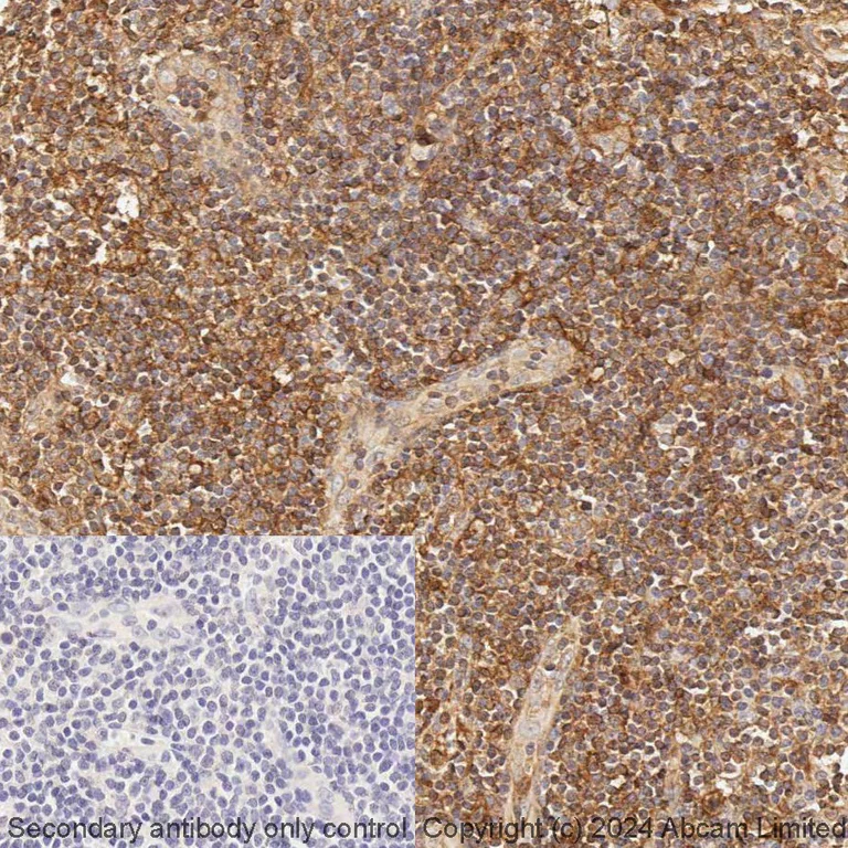 Immunohistochemistry (Formalin/PFA-fixed paraffin-embedded sections) - BOND RX - Anti-HLA A antibody [EP1395Y] (AB321950)