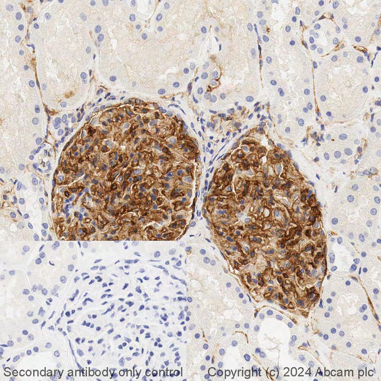 Immunohistochemistry (Formalin/PFA-fixed paraffin-embedded sections) - BOND RX - Anti-ICAM1 antibody [EP1442Y] (AB325206)