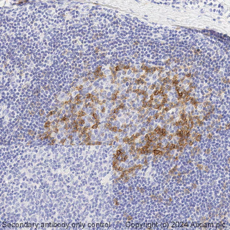 Immunohistochemistry (Formalin/PFA-fixed paraffin-embedded sections) - BOND RX - Anti-ICOS antibody [EPR20560] (AB325207)