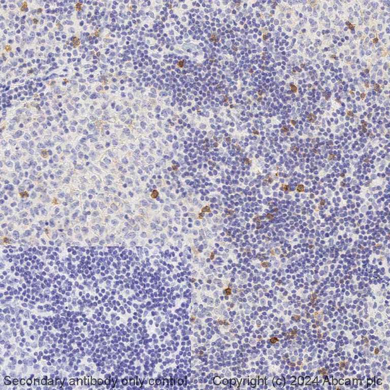Immunohistochemistry (Formalin/PFA-fixed paraffin-embedded sections) - BOND RX - Anti-IL-2 Receptor alpha antibody [EPR6452] (AB325208)
