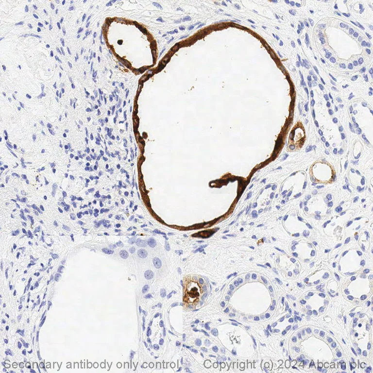 Immunohistochemistry (Formalin/PFA-fixed paraffin-embedded sections) - BOND RX - Anti-MMP7 antibody [EPR17888-71] (AB325210)