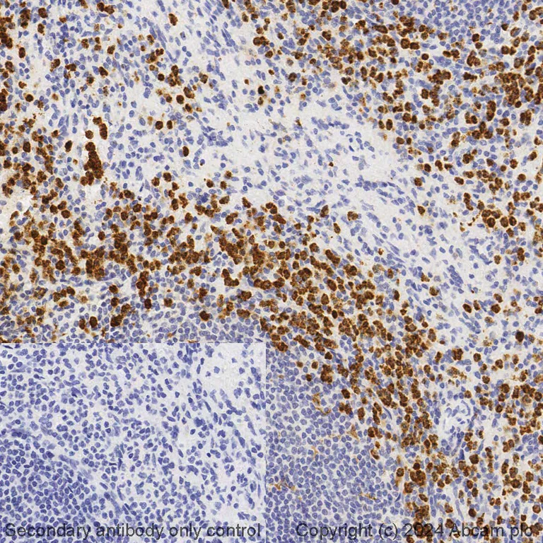 Immunohistochemistry (Formalin/PFA-fixed paraffin-embedded sections) - BOND RX - Anti-MMP9 antibody [EP1254] (AB325211)