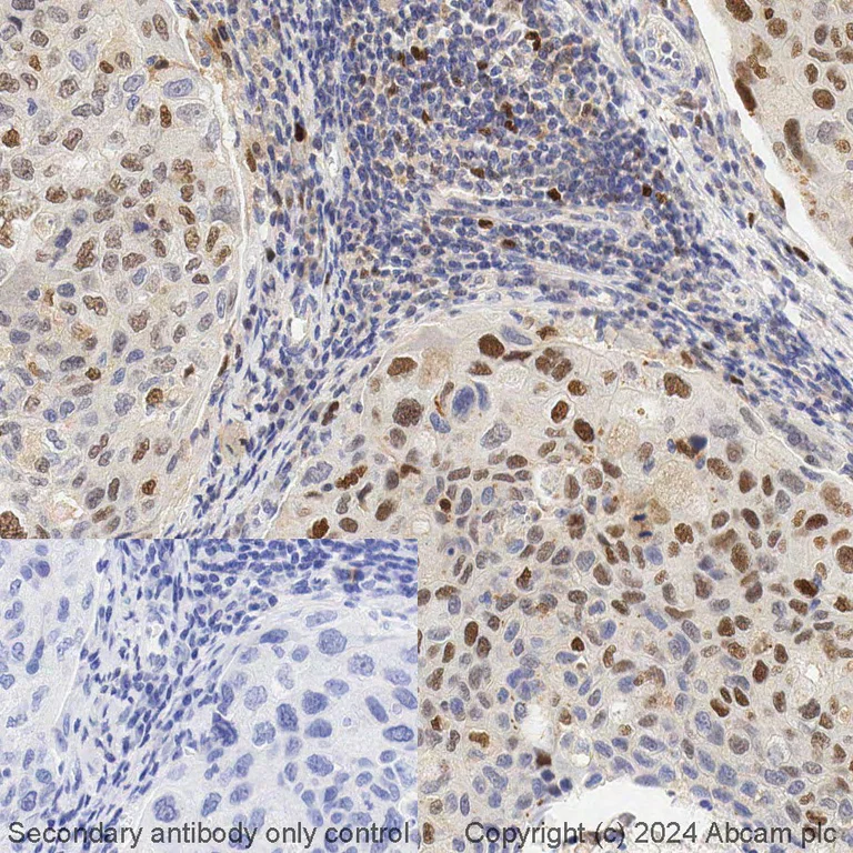 Immunohistochemistry (Formalin/PFA-fixed paraffin-embedded sections) - BOND RX - Anti-Nrf2 (phospho S40) antibody [EP1809Y] (AB325212)