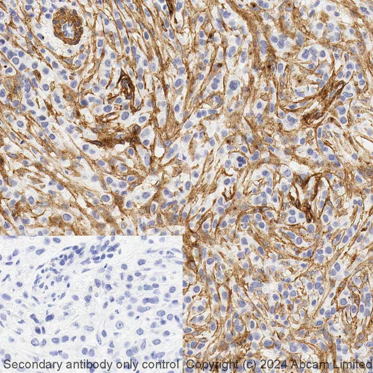 Immunohistochemistry (Formalin/PFA-fixed paraffin-embedded sections) - BOND RX - Anti-PDGFR alpha + PDGFR beta antibody [Y92] - C-terminal (AB321948)