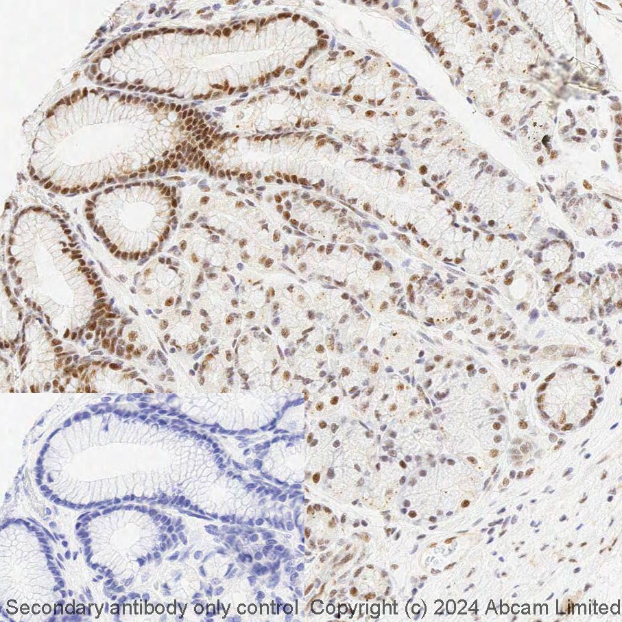 Immunohistochemistry (Formalin/PFA-fixed paraffin-embedded sections) - BOND Rx - Anti-Smad3 (phospho S423 + S425) antibody [EP823Y] (AB321949), expandable thumbnail