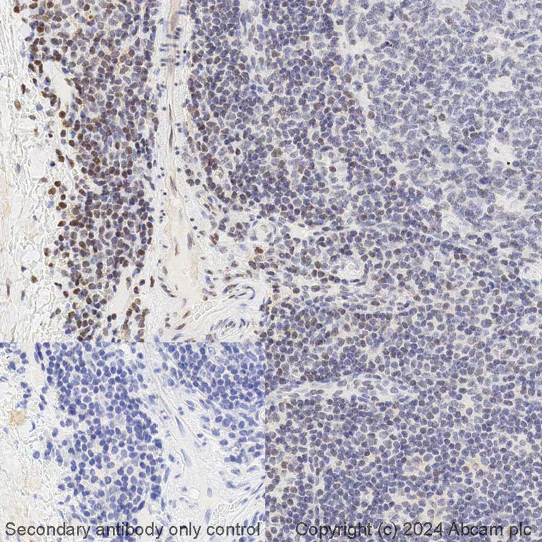 Immunohistochemistry (Formalin/PFA-fixed paraffin-embedded sections) - BOND RX - Anti-STAT5 (phospho Y694) antibody [E208] (AB325214)