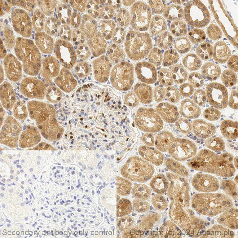 Immunohistochemistry (Formalin/PFA-fixed paraffin-embedded sections) - BOND RX - Anti-TMPRSS2 antibody [EPR3862] (AB325215)