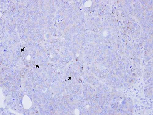 Immunohistochemistry (Formalin/PFA-fixed paraffin-embedded sections) - Anti-Bone marrow stromal cell antigen 1 antibody (AB137718), expandable thumbnail