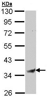 Western blot - Anti-Bone marrow stromal cell antigen 1 antibody (AB137718), expandable thumbnail