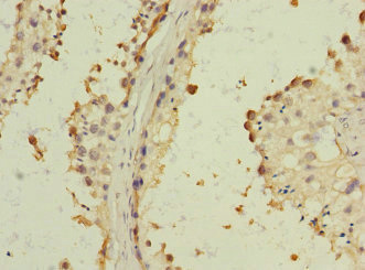 Immunohistochemistry (Formalin/PFA-fixed paraffin-embedded sections) - Anti-Bone marrow stromal cell antigen 1 antibody (AB235786)