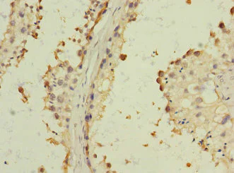 Immunohistochemistry (Formalin/PFA-fixed paraffin-embedded sections) - Anti-Bone marrow stromal cell antigen 1 antibody (AB235786)