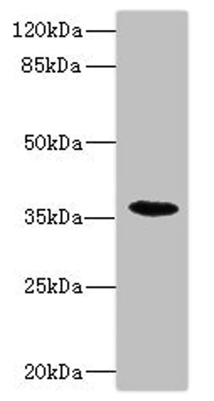 Western blot - Anti-Bone marrow stromal cell antigen 1 antibody (AB235786)