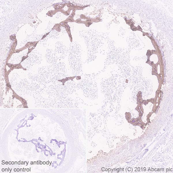 Immunohistochemistry (Formalin/PFA-fixed paraffin-embedded sections) - Anti-Bone Sialoprotein antibody [EPR23243-30] - BSA and Azide free (AB270615), expandable thumbnail