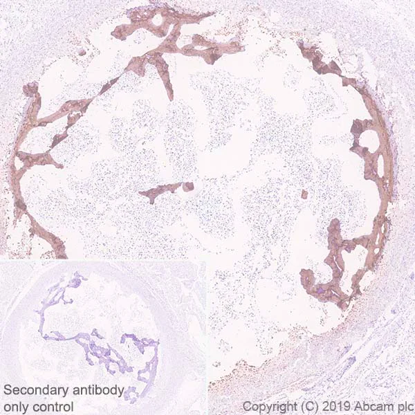 Immunohistochemistry (Formalin/PFA-fixed paraffin-embedded sections) - Anti-Bone Sialoprotein antibody [EPR23243-30] - BSA and Azide free (AB270615)