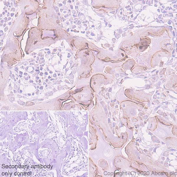 Immunohistochemistry (Formalin/PFA-fixed paraffin-embedded sections) - Anti-Bone Sialoprotein antibody [EPR23243-30] - BSA and Azide free (AB270615), expandable thumbnail