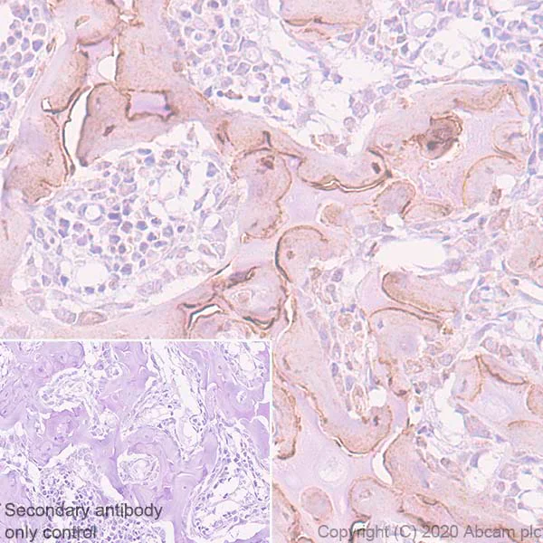 Immunohistochemistry (Formalin/PFA-fixed paraffin-embedded sections) - Anti-Bone Sialoprotein antibody [EPR23243-30] - BSA and Azide free (AB270615)