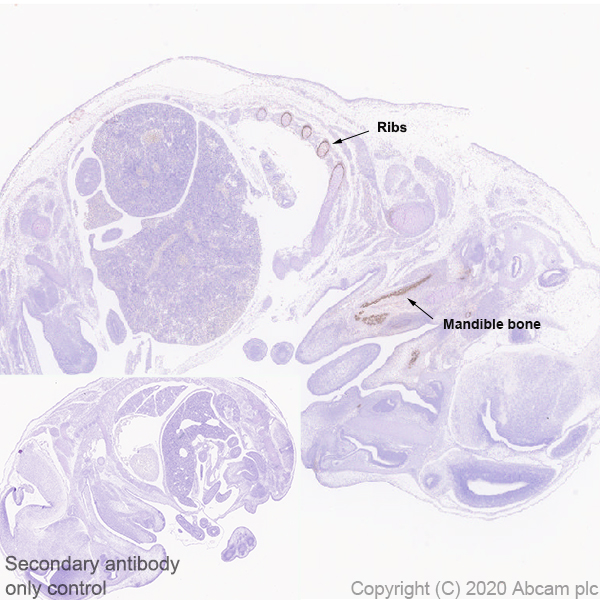 Immunohistochemistry (Formalin/PFA-fixed paraffin-embedded sections) - Anti-Bone Sialoprotein antibody [EPR23367-50] - BSA and Azide free (AB272320), expandable thumbnail