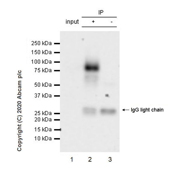 Immunoprecipitation - Anti-Bone Sialoprotein antibody [EPR23367-50] - BSA and Azide free (AB272320), expandable thumbnail