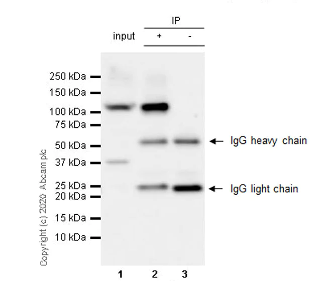 Immunoprecipitation - Anti-BOP1 antibody [6H11] - BSA and Azide free (AB255775)