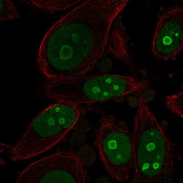 Immunocytochemistry/ Immunofluorescence - Anti-BOP1 antibody (AB222190)