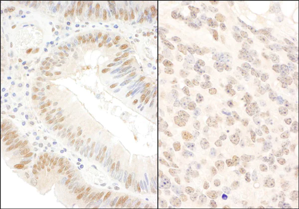 Immunohistochemistry (Formalin/PFA-fixed paraffin-embedded sections) - Anti-BOP1 antibody (AB86652)