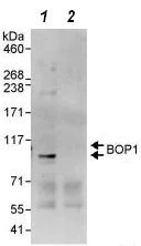 Immunoprecipitation - Anti-BOP1 antibody (AB86652)