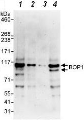 Western blot - Anti-BOP1 antibody (AB86653)