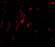 Immunocytochemistry/ Immunofluorescence - Anti-Borealin/CDCA8 antibody (AB74473)