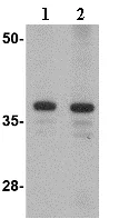 Western blot - Anti-Borealin/CDCA8 antibody (AB74473)