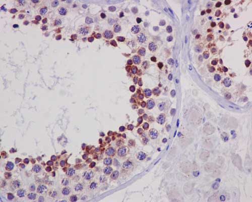 Immunohistochemistry (Formalin/PFA-fixed paraffin-embedded sections) - Anti-BORIS antibody [EP12204] (AB187163)