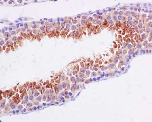 Immunohistochemistry (Formalin/PFA-fixed paraffin-embedded sections) - Anti-BORIS antibody [EP12204] - BSA and Azide free (AB269929)