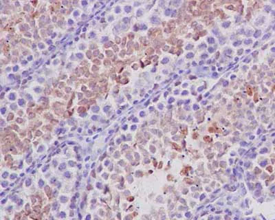 Immunohistochemistry (Formalin/PFA-fixed paraffin-embedded sections) - Anti-BORIS antibody [EP12204] - BSA and Azide free (AB269929)