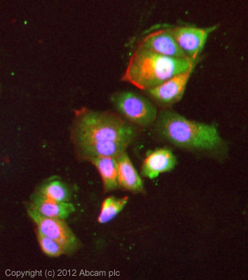 Immunocytochemistry/ Immunofluorescence - Anti-BORIS antibody [KT72] (AB111255)