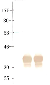 Western blot - Anti-BORIS antibody [KT72] (AB111255)